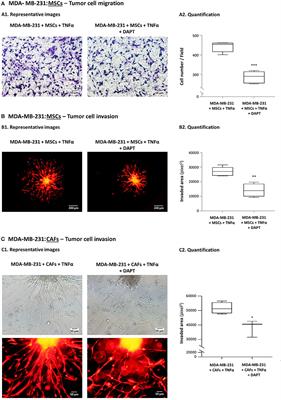 Notch-Mediated Tumor-Stroma-Inflammation Networks Promote Invasive Properties and CXCL8 Expression in Triple-Negative Breast Cancer